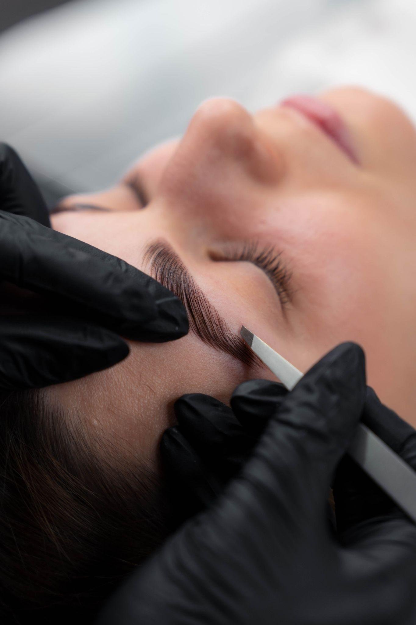 brow-lift-1