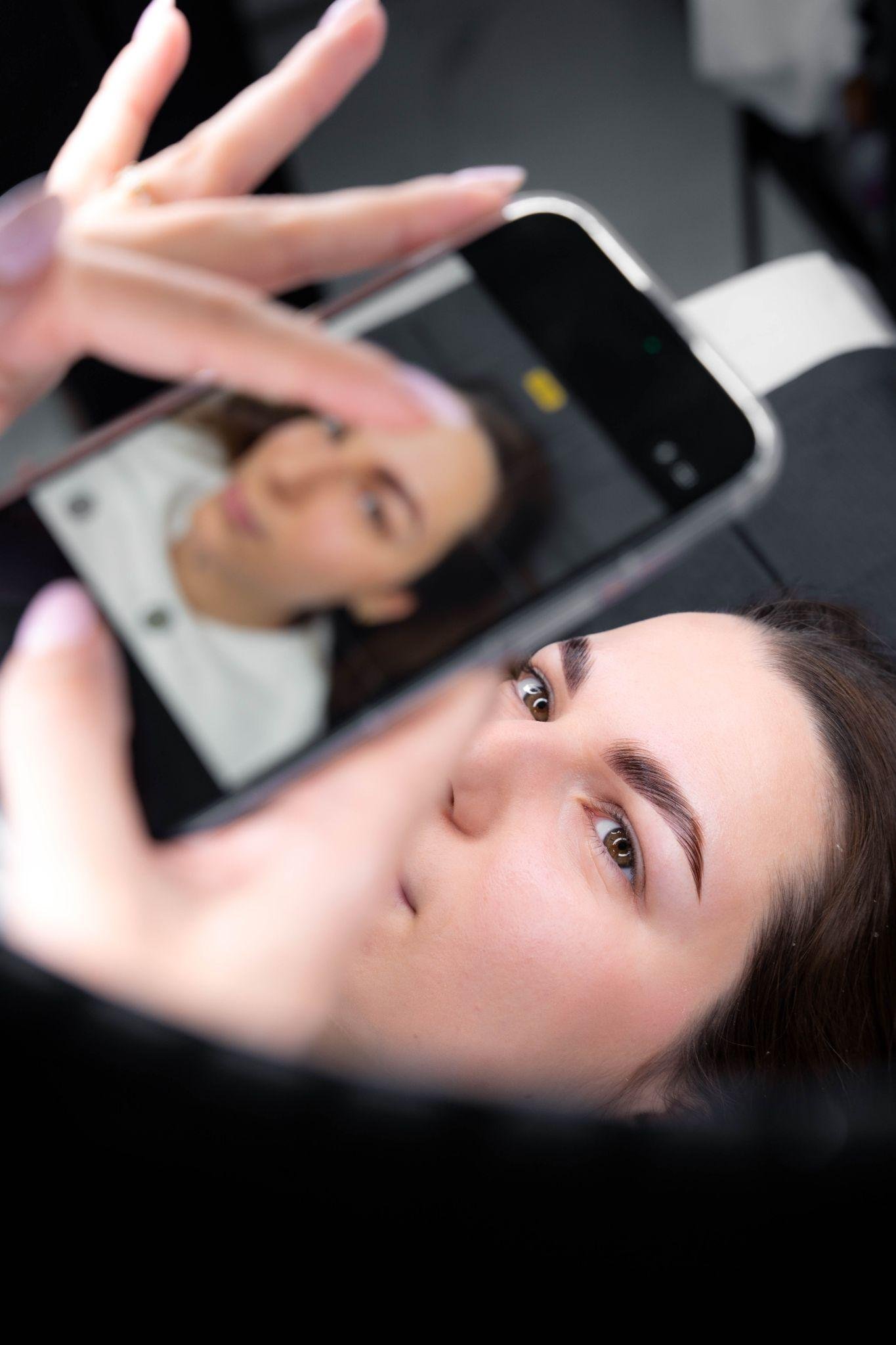 brow-lift-2